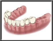 implant diagram 5