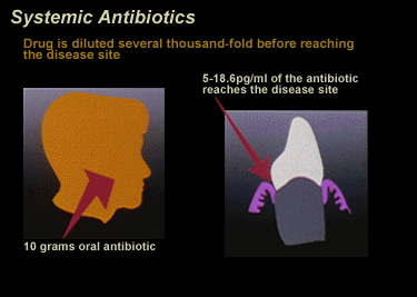 Systemic Antibiotic Diagram